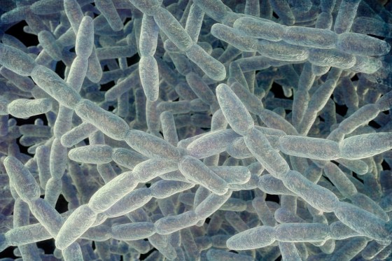 Legionnaires' disease outbreak on the Upper East Side